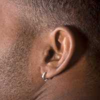 Hoe herken je een nikkelallergie? - Aramat Jewels